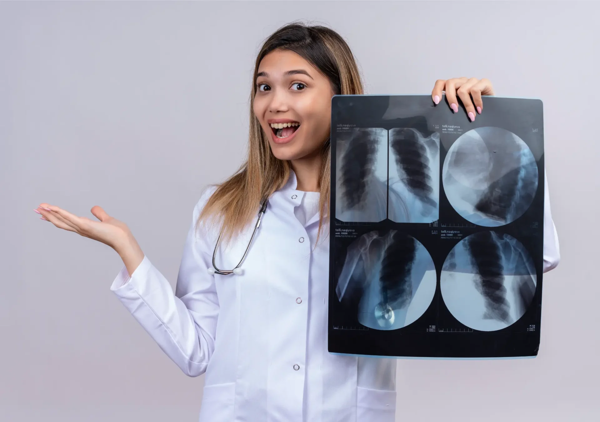 Young beautiful woman doctor wearing white coat with stethoscope holding x ray lungs